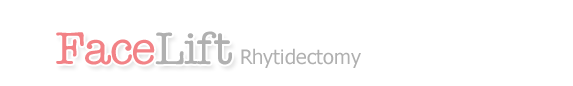Face Lift Rhytidectomy
